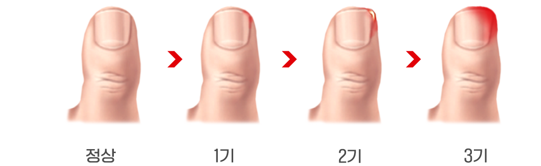 이미지명