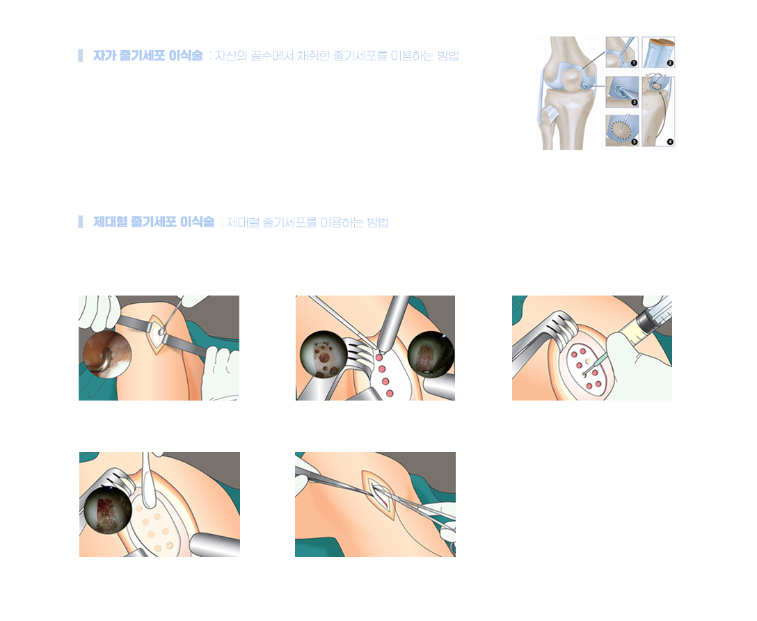 이미지명