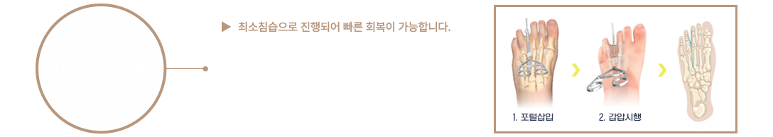 이미지명