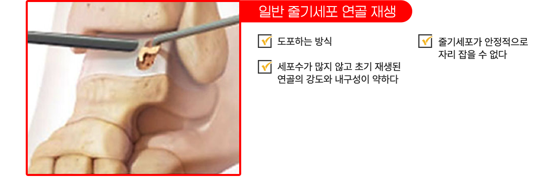 이미지명
