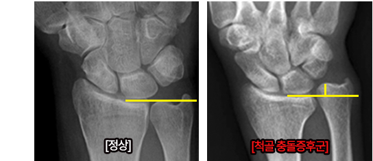 이미지명