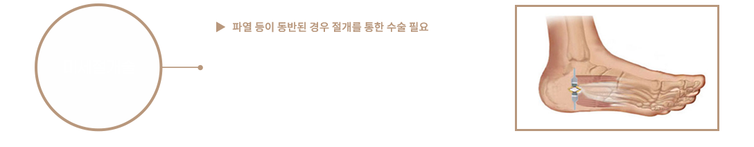 이미지명