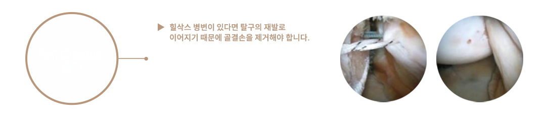 이미지명