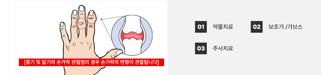 이미지명
