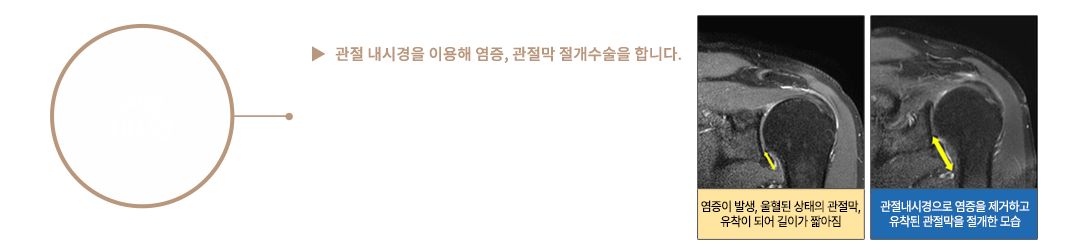이미지명