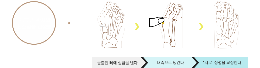 이미지명