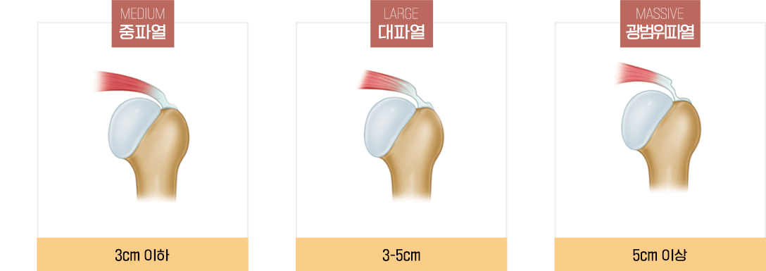 이미지명