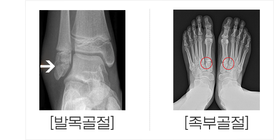 이미지명
