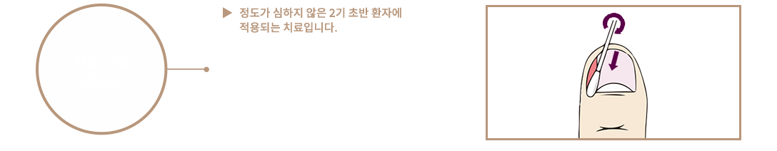 이미지명