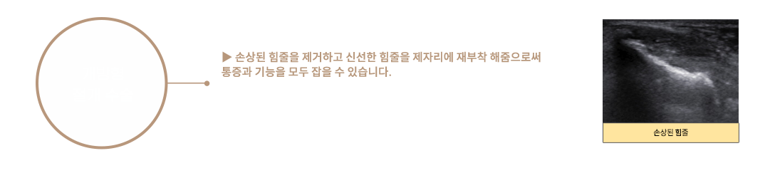 이미지명