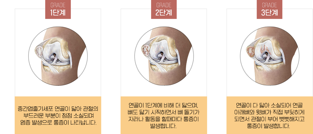 이미지명