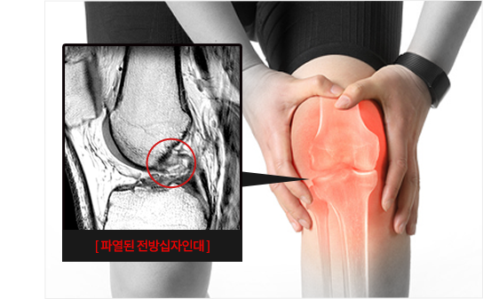 이미지명