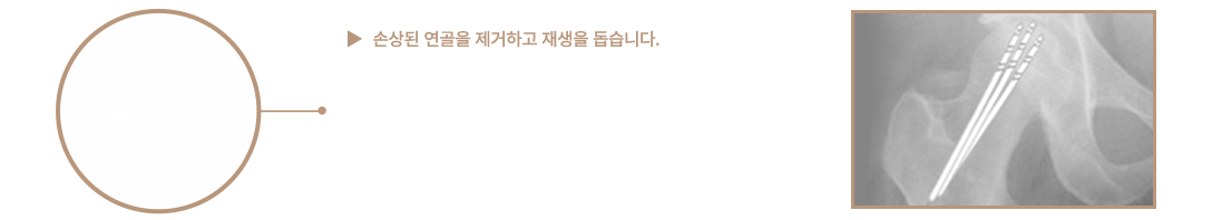 이미지명