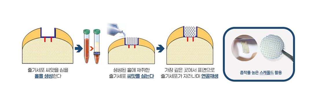이미지명