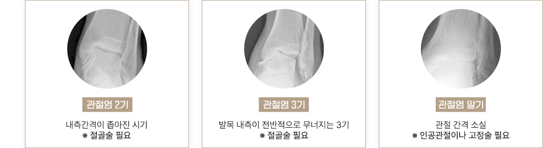 이미지명