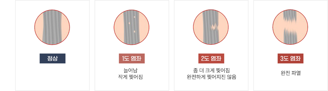 이미지명