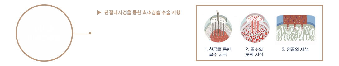 이미지명