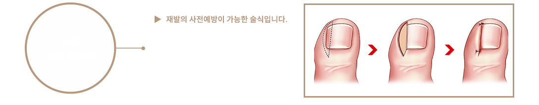 이미지명