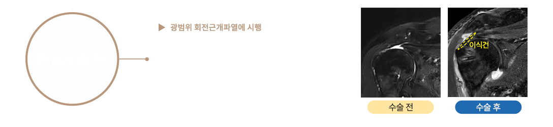 이미지명