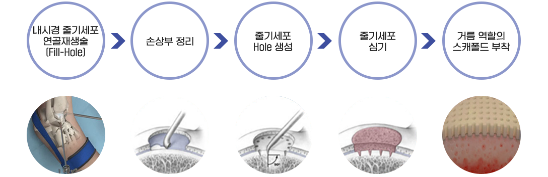 이미지명