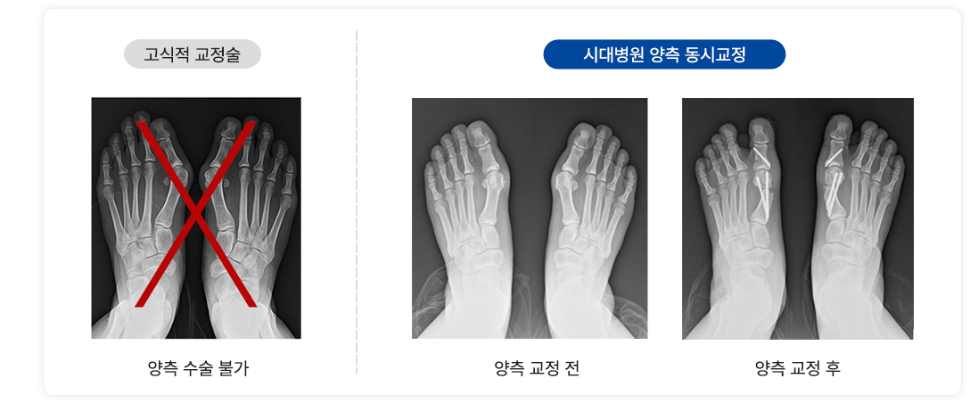 이미지명