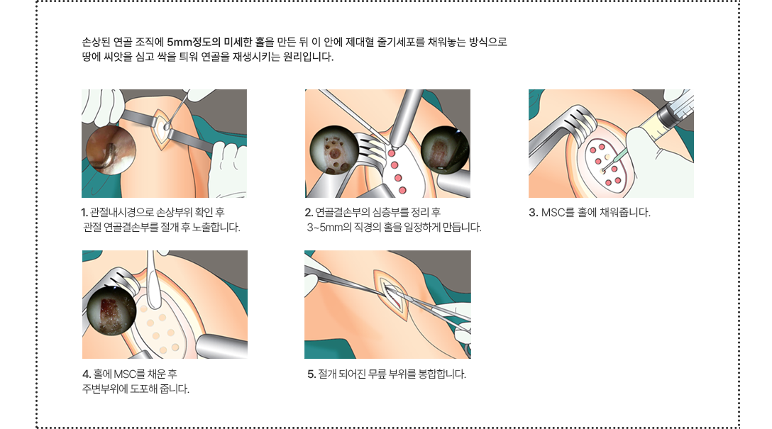 이미지명