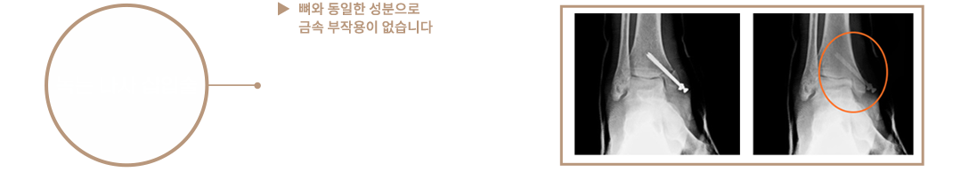 이미지명