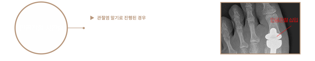 이미지명