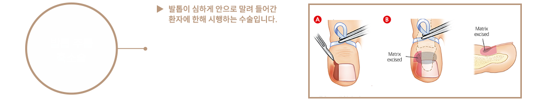 이미지명