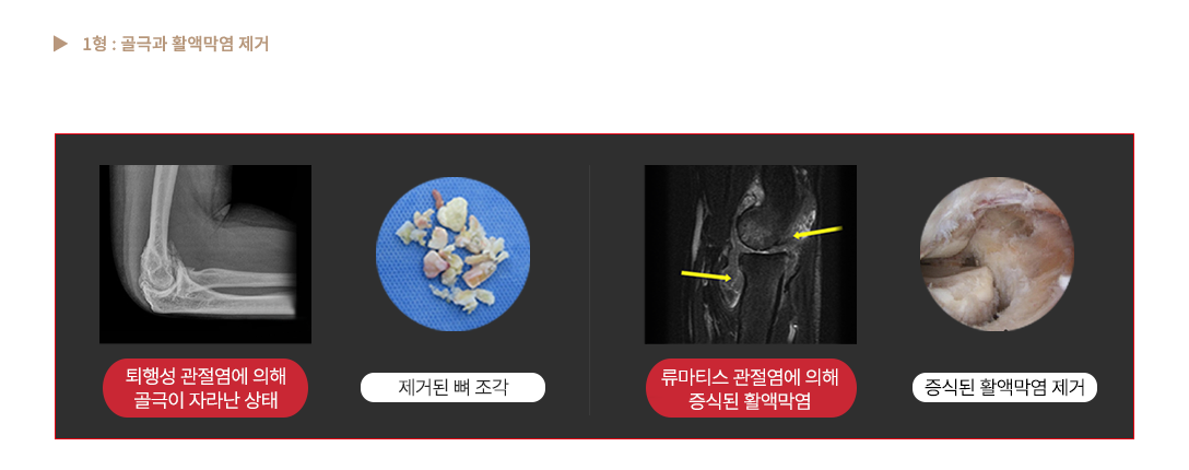 이미지명