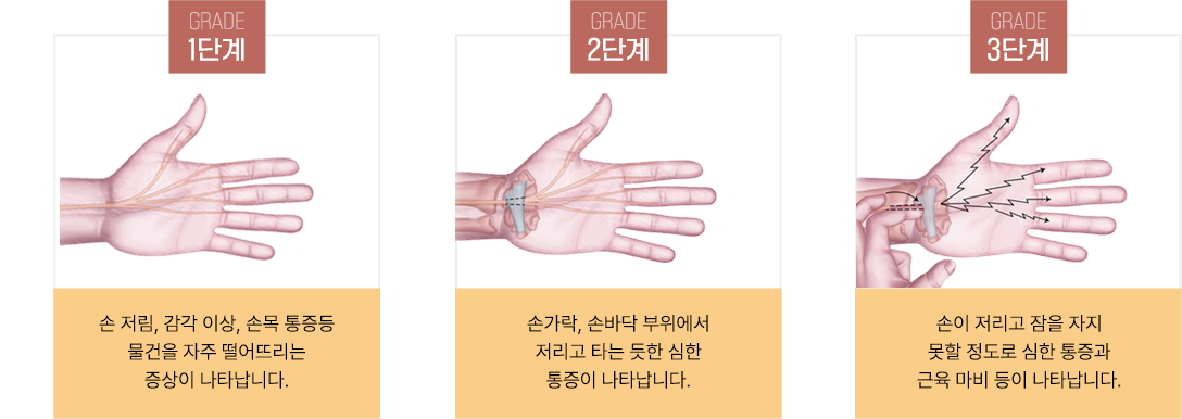 이미지명