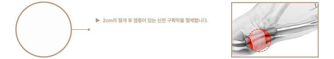이미지명