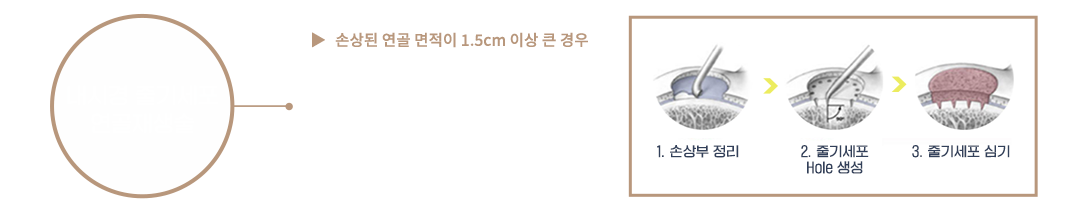 이미지명
