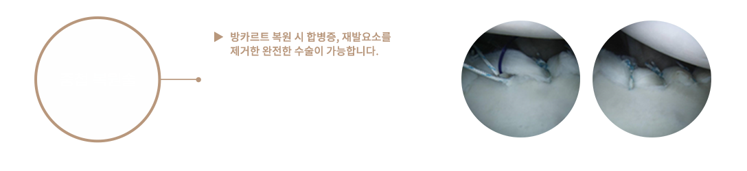 이미지명