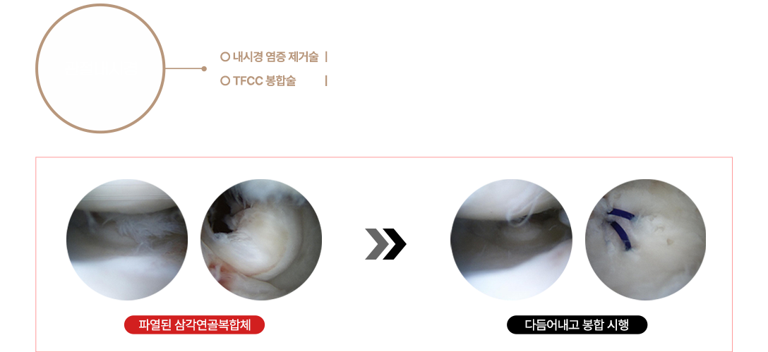 이미지명