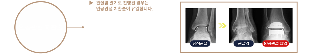 이미지명