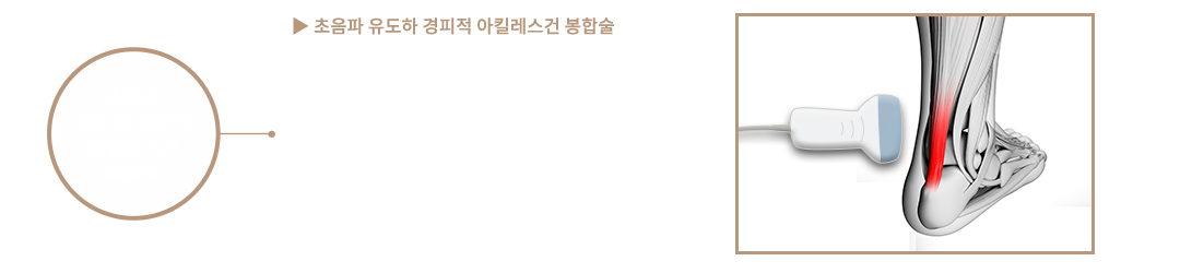 이미지명