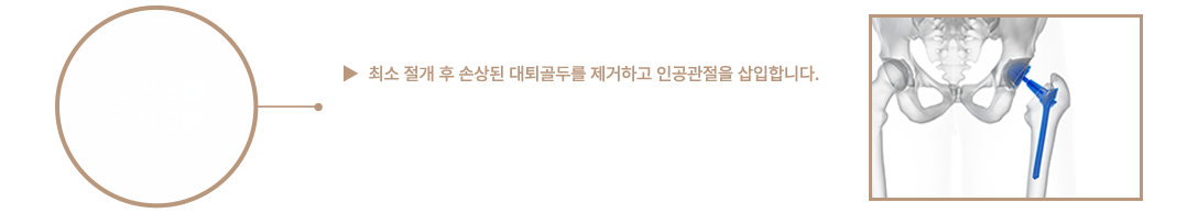 이미지명