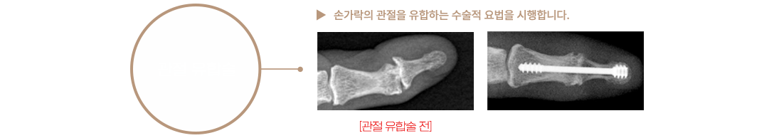 이미지명