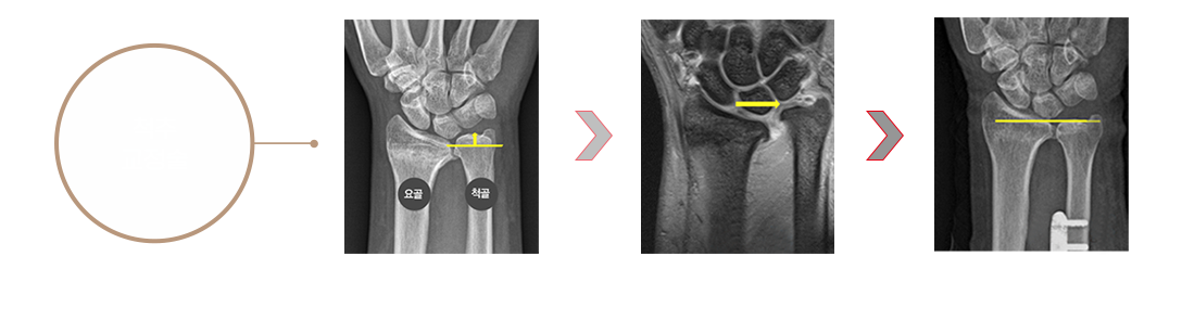 이미지명