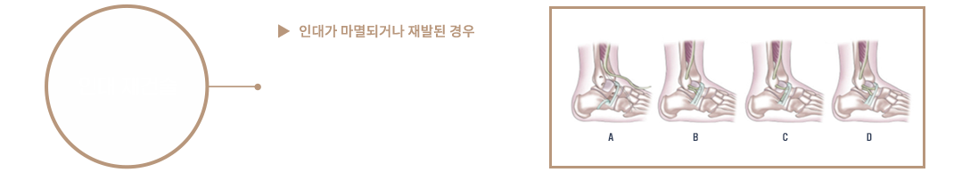 이미지명