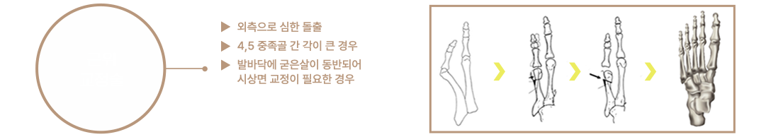 이미지명