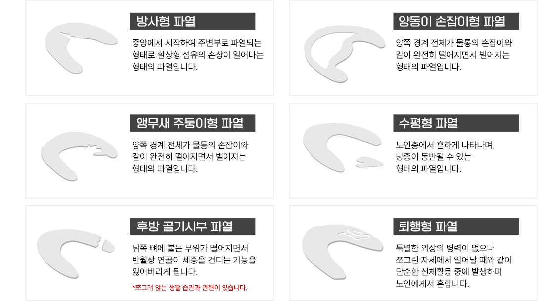 이미지명