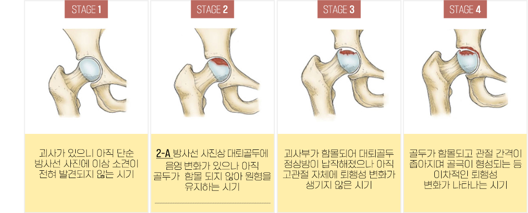 이미지명