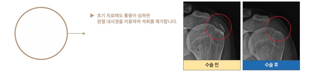 이미지명