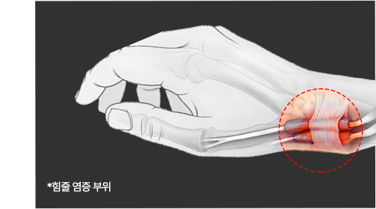 이미지명