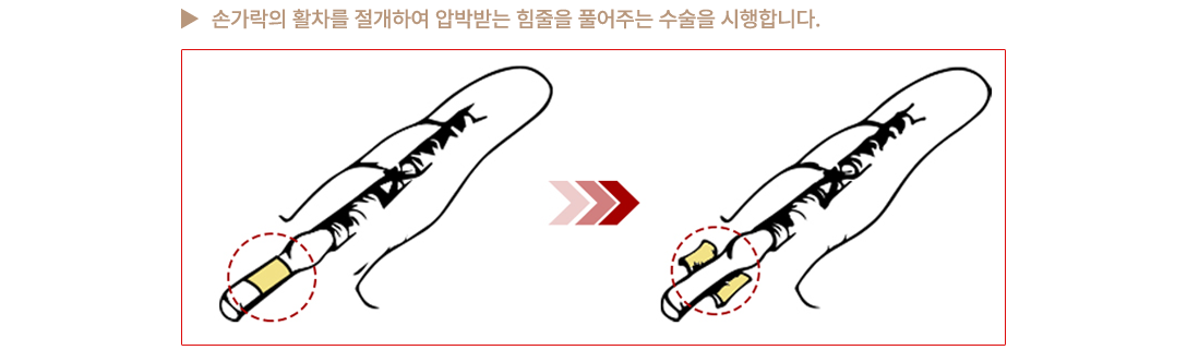 이미지명