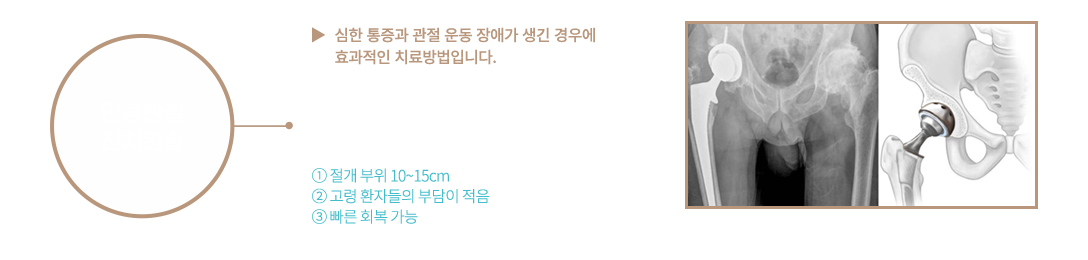 이미지명