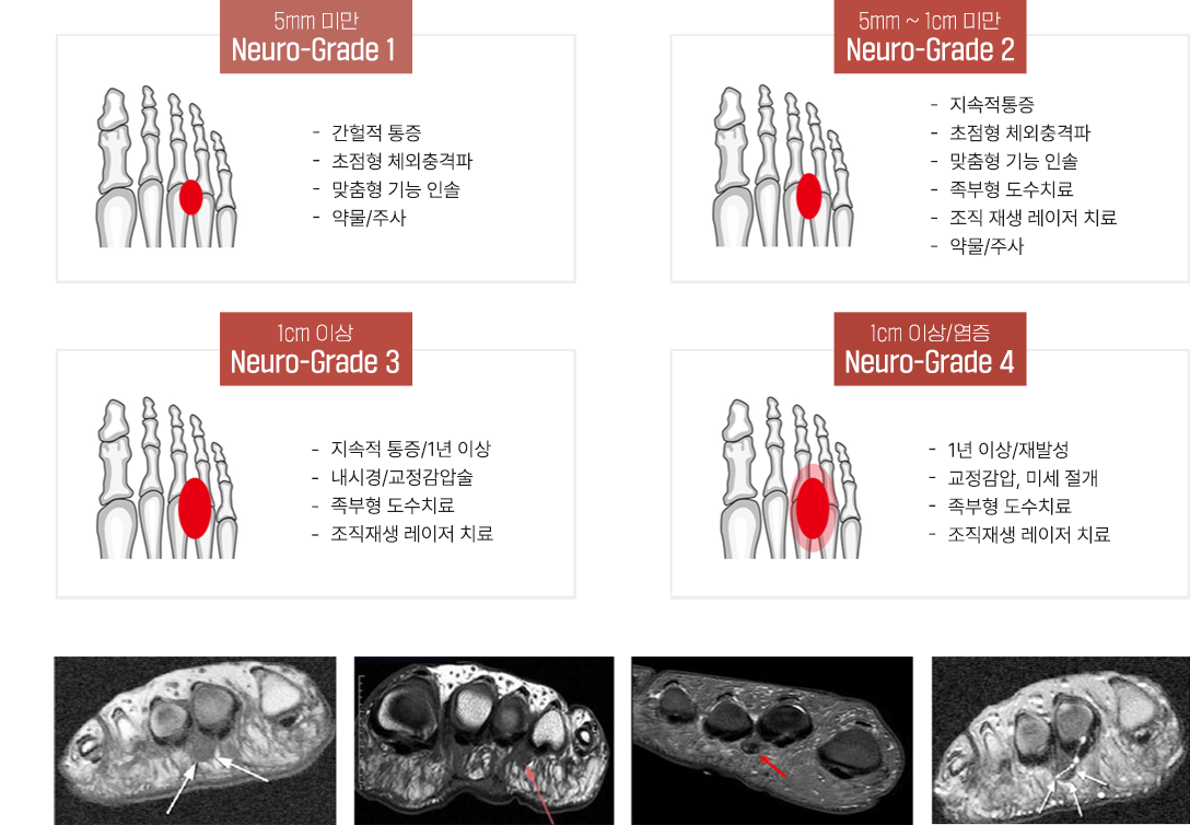 이미지명