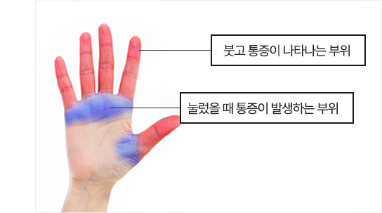 이미지명